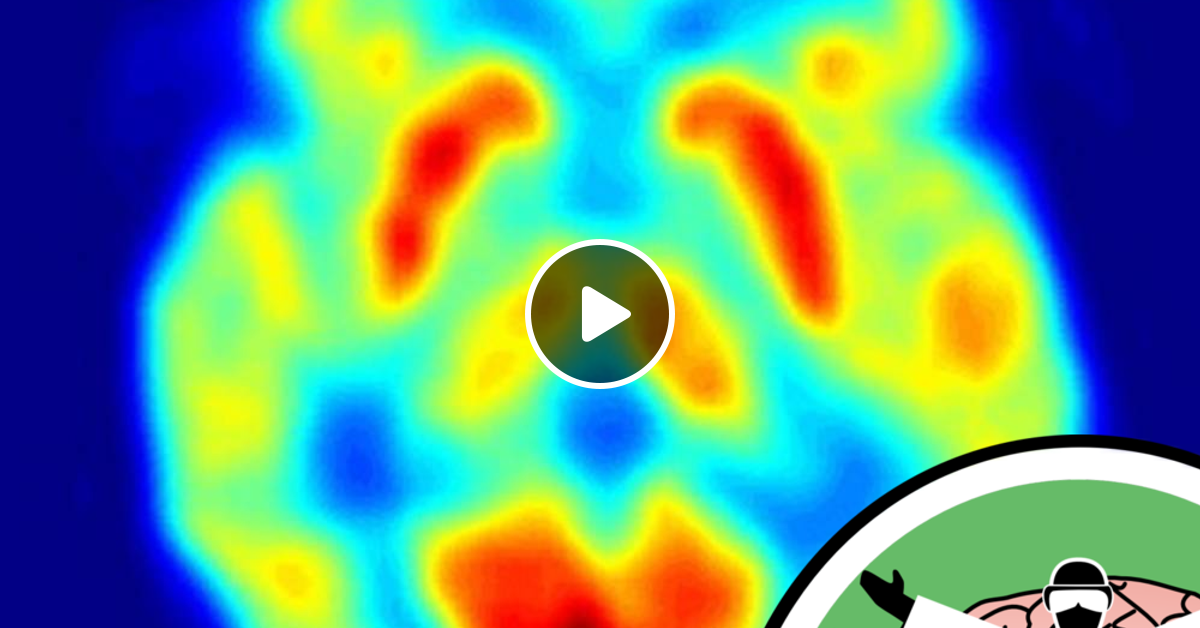 The Naked Scientists Unravel The Connections In Your Brain By Naked Neuroscience From The N
