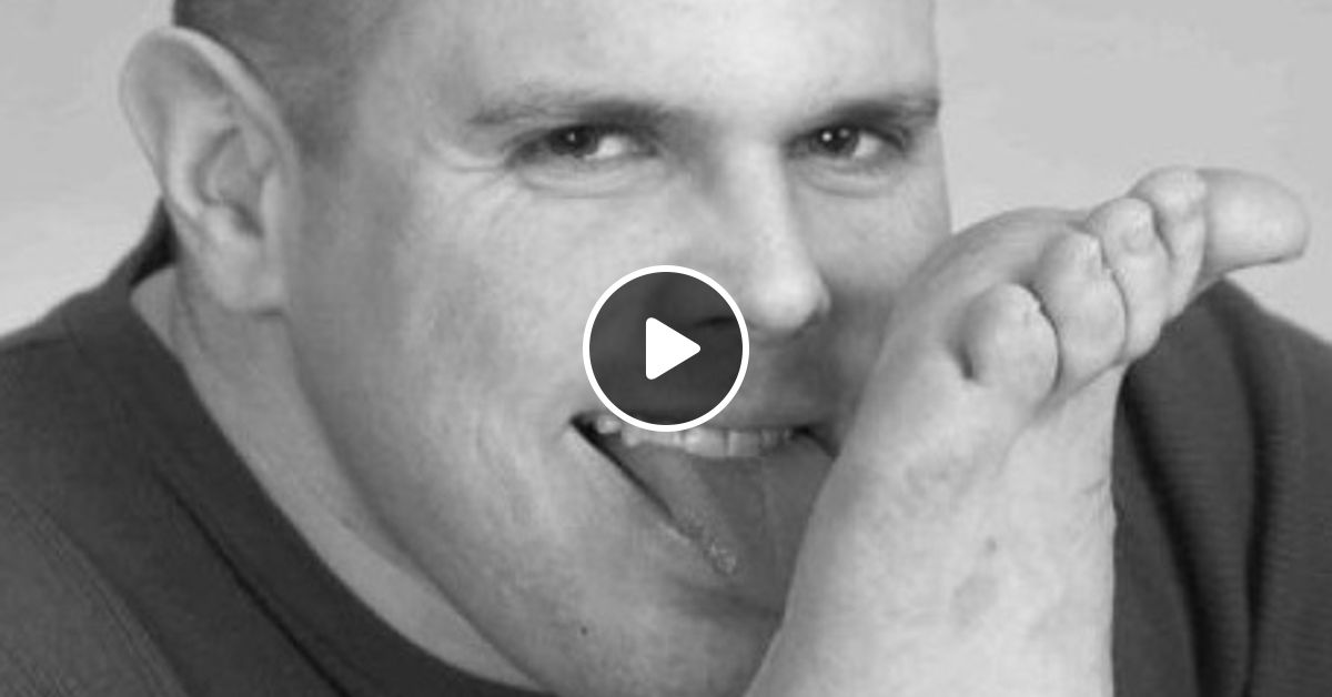 pee-hole-surgery-by-misteranthropic-mixcloud
