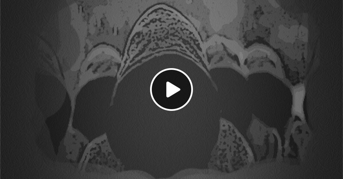 Aleksandra Medakovic Dumasaphobia Techno Mix 2014 By Aleksandra Medakovic Mixcloud Dumasaphobia and the phonetic spelling are copyright © 2007 mixcloud