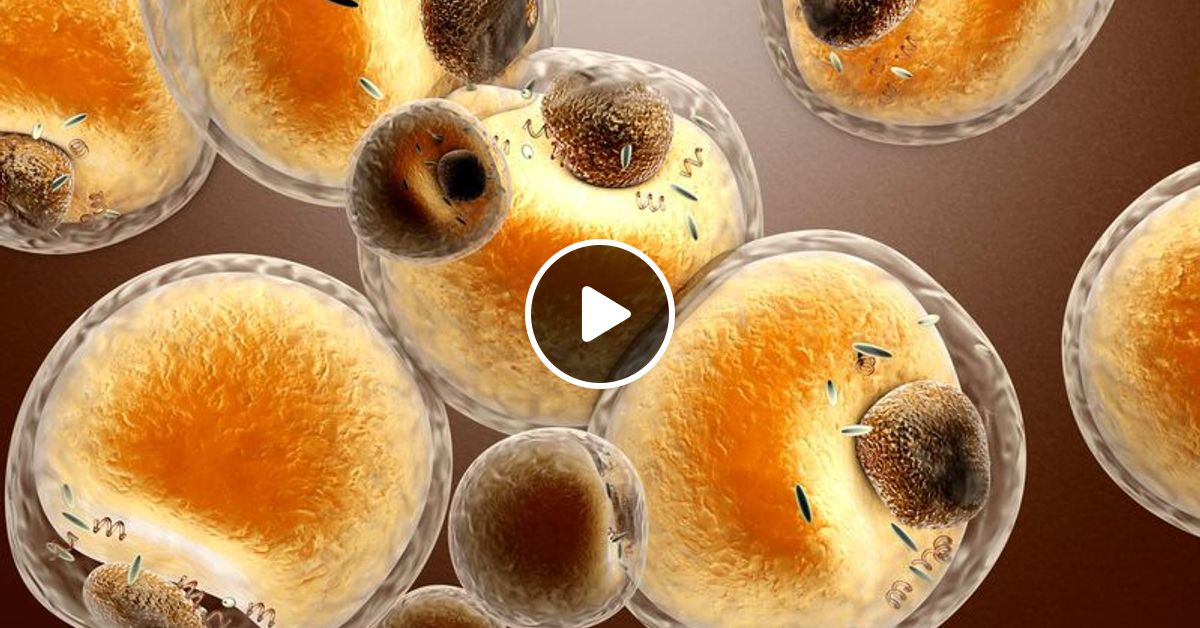 Borderline Cholesterol Levels by Kič Ma Mixcloud