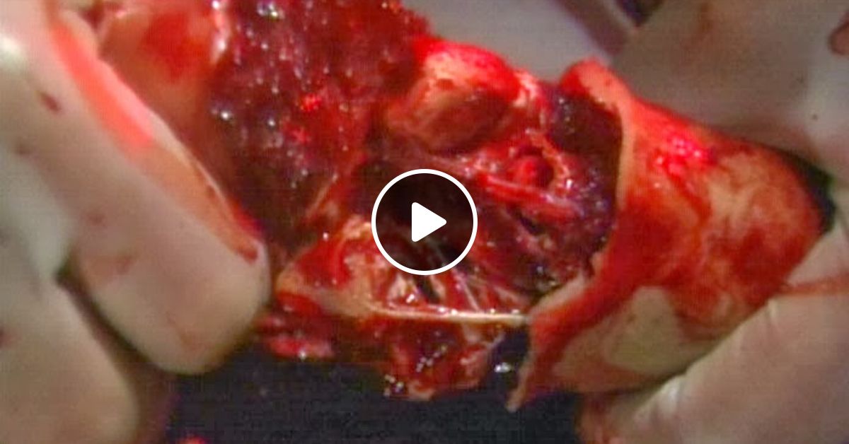 x log 7=-2 [Dubstep Annihilator    Brutal  Brutal Gore Kill Mix