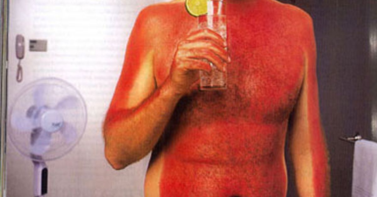 сгорела в солярии