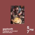 Gaptooth 27-07-21 <3