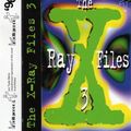 X-Ray - The X-Ray Files 3 (Intelligence 1996)