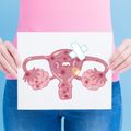 Aumenta la incidencia de cáncer de cuello uterino en Puerto Rico