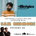 The Allergies Podcast Episode #58 (with guest Sam Redmore)