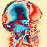 Braindamage (RiSo Delic)