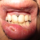 THE GRIMEY MOUTH MIX
