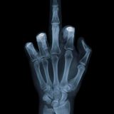 Fuck You