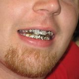 STIENSKI SELECTA - MOUTHFUL OF GOLD II