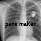 Pace Maker