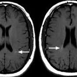 Enrico T - Fusion Brain