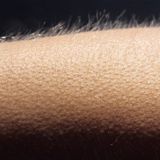 Goosebumps