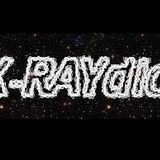 X-RAYdio 12/07/2013