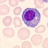 Plasmocyte
