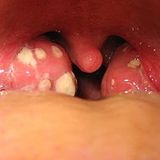 the viral infection mix