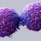 Le cancer (25 novembre 2015)