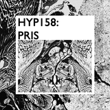 Hyp 158: Pris
