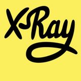 Xray - Tom Cullen (13/06/15)
