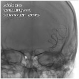 Slob09 - Aneurysm - Summer 2015