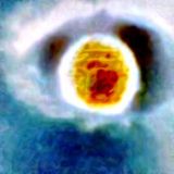 Cloudy Vision (Part Two)