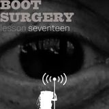 boot surgery: lesson 17