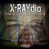 X-RAYdio 19/02/2013 Butterflies