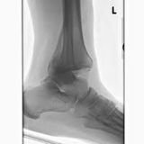 Hand made series vol 6 : The broken ankle mix