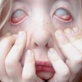 Disturbed