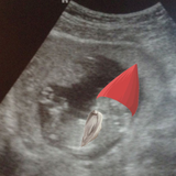 Womb Tunes