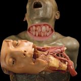 18#dentition-trépanation abolition-des-sensations finition-à-répétition tradition excitation-et-exci