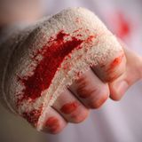 Bloody but Unbowed