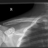 Clavicula Issues (2008)