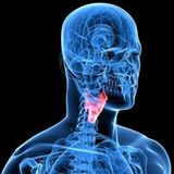 iTRay "LARYNGITIS"
