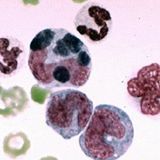 Anaplasmoses