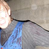 Acid bath mix