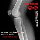 DallasK, KSHMR vs ZHU - Burn vs Faded (Scooter & Lavelle smush)
