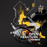 Open Fracture