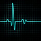 Pulse