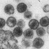 Betaretrovirus