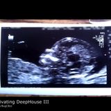 Bug© - Progressivating DeepHouse III (Sunday Session 2013-08-11 )