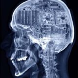 Victor AG - Electrical brain