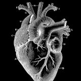 Enlarged Heart Radio #2