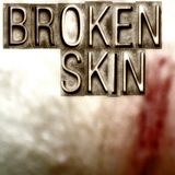 broken skin mx (20072012)
