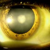 Cloudy Vision (Part Four)
