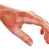 Ayurvedic Management of Skin Problems –Part 3