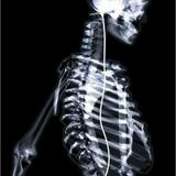 X-ray In Full Effect