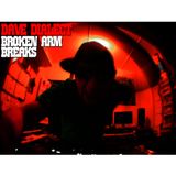 Dave Dialect - Broken Arm Breaks Mix