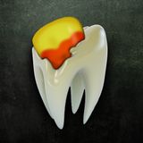Concrete Candy Corn