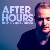 After Hours Vol. 14